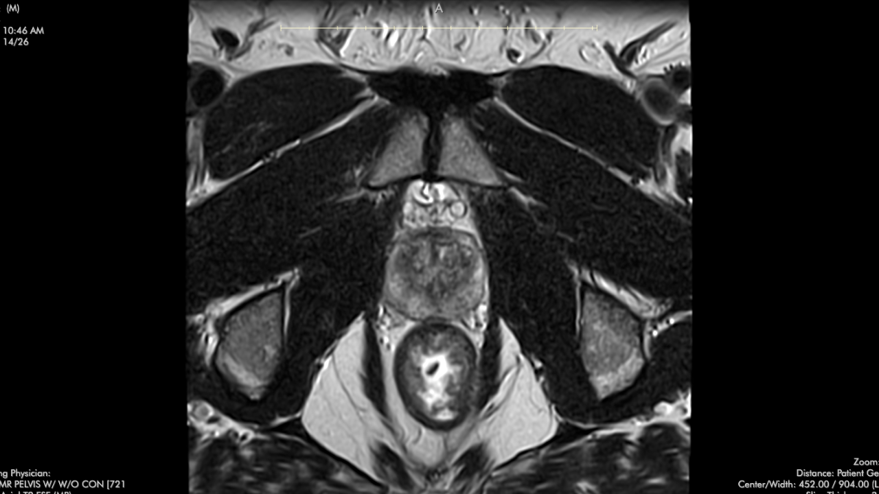 PET CT - Radiology Course - MRI Online is now Medality