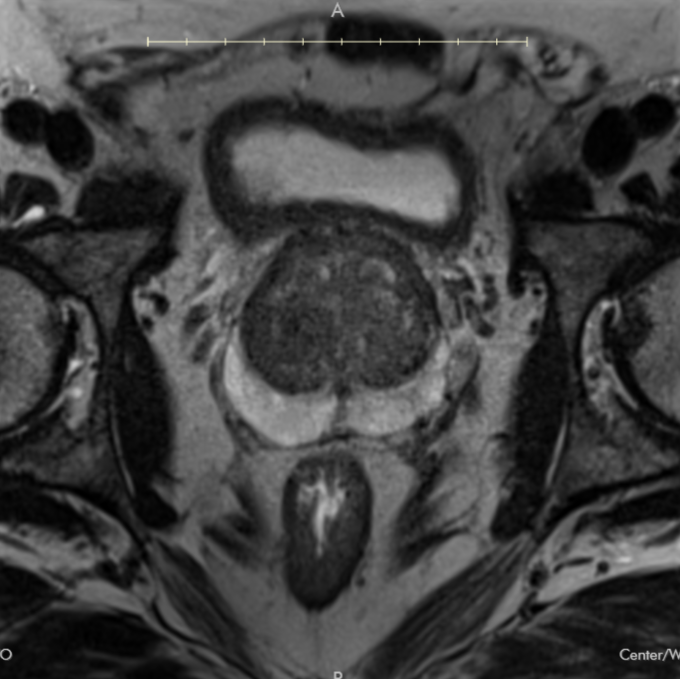 Prostate MRI 2.0 Practice Cases - Radiology Course - Medality / MRI Online